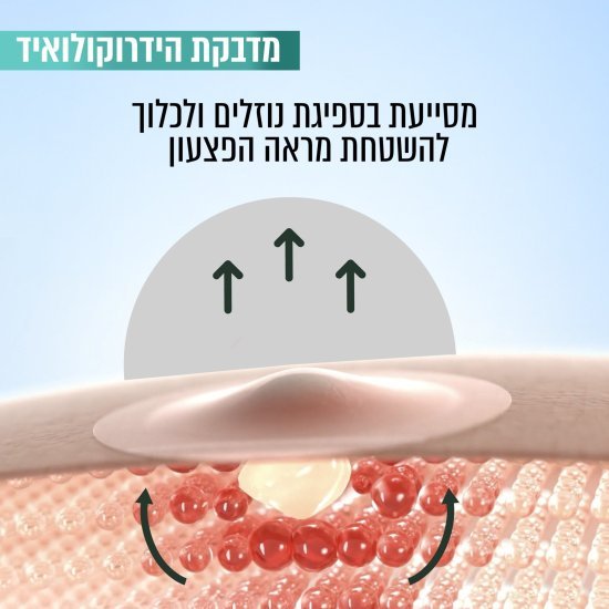 מדבקות נגד פצעונים פיור אקטיב גרנייה – 22 יחידות